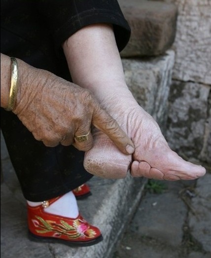 实拍三寸金莲裹脚缠足全过程