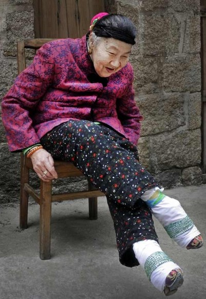 图说最后一代裹脚的女人
